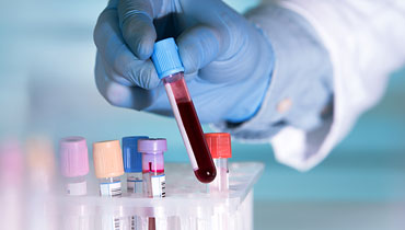 LAB SAMPLES
MANAGEMENT